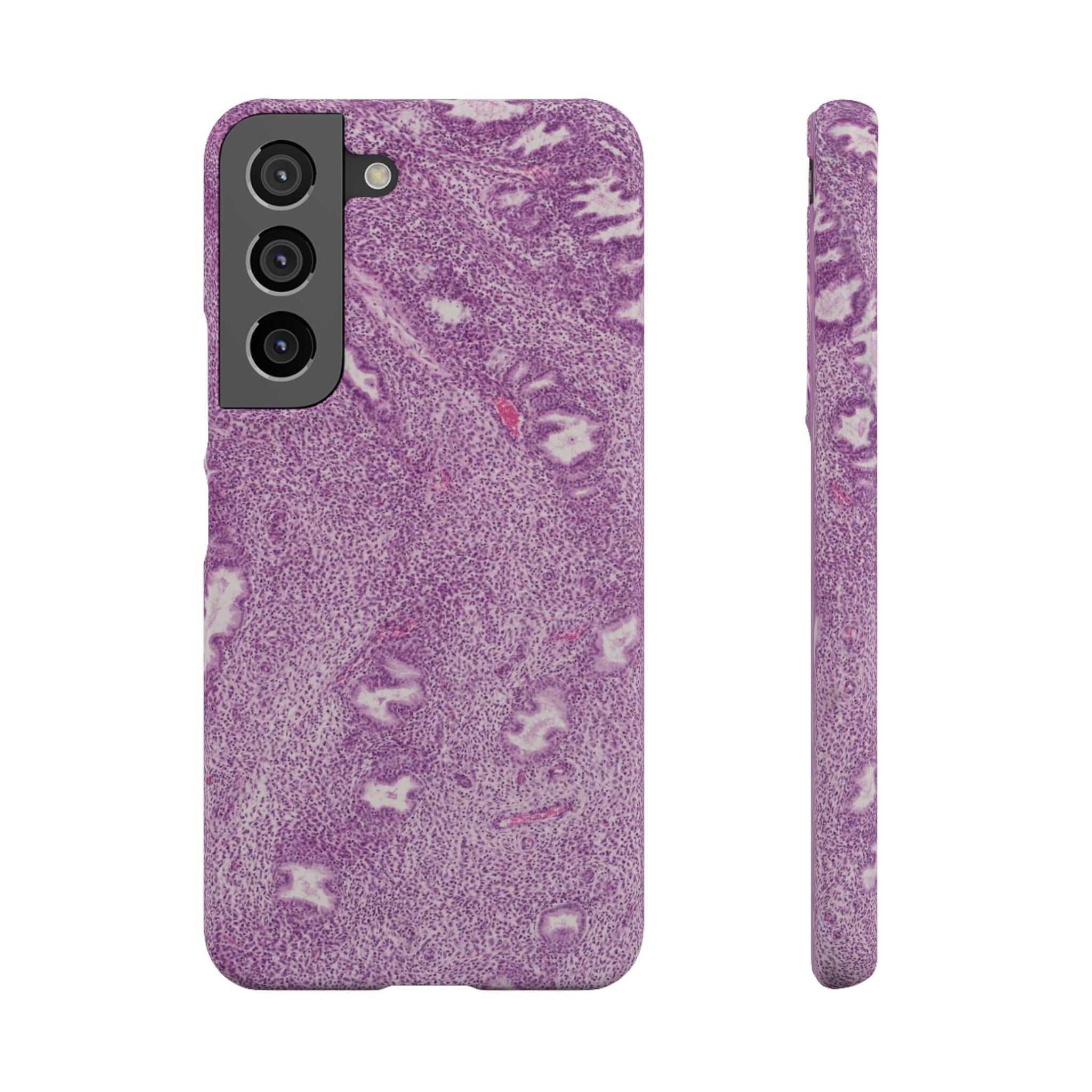 Slim Case Endometrium