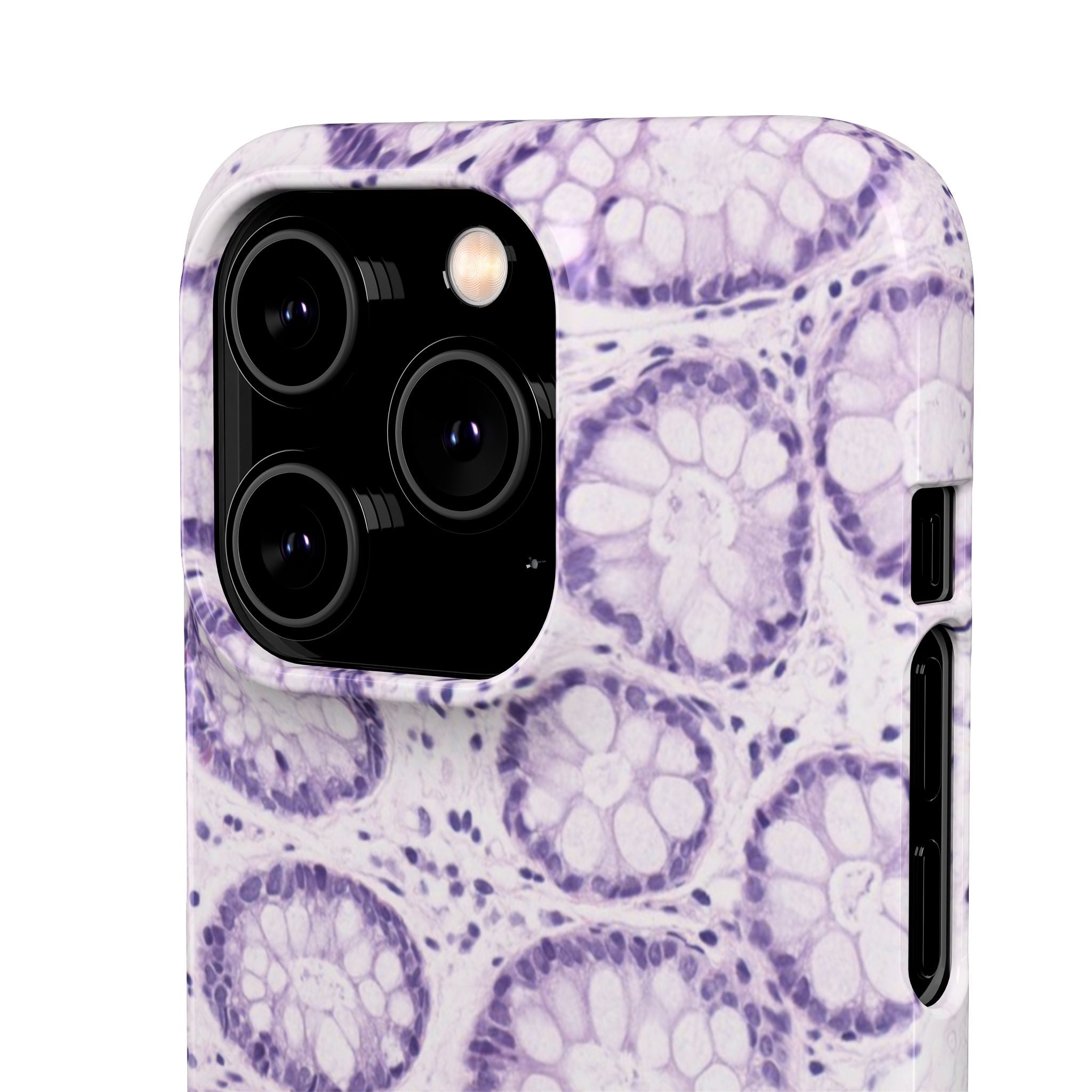 Slim Case Kolon