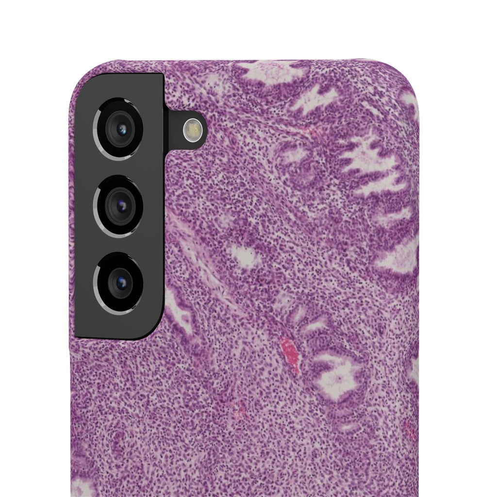 Slim Case Endometrium