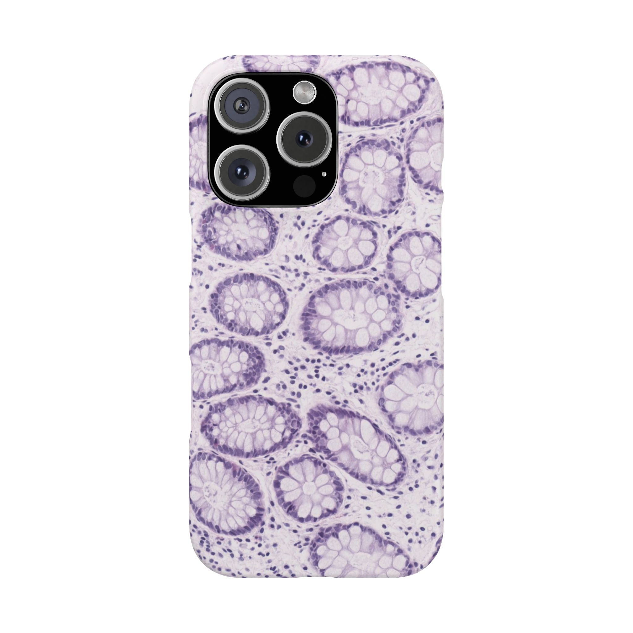 Slim Case Kolon