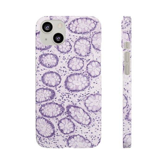 Slim Case Kolon