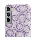 Slim Case Kolon