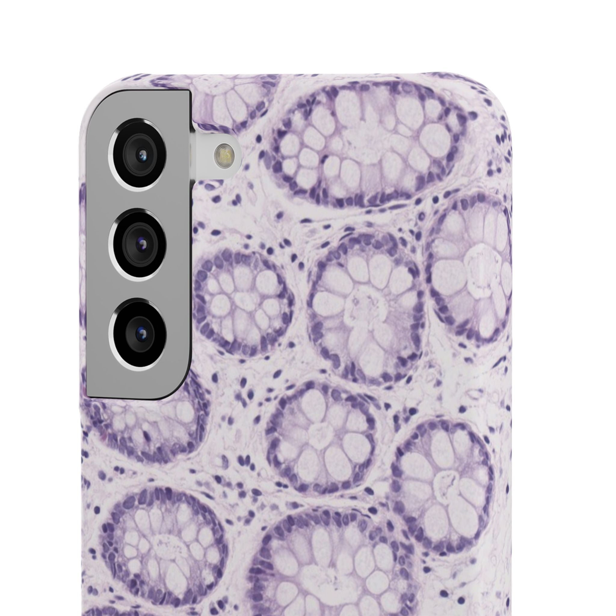 Slim Case Kolon