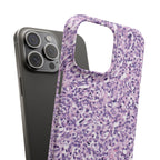 Slim Case Paraganglion