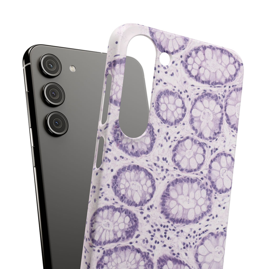 Slim Case Kolon