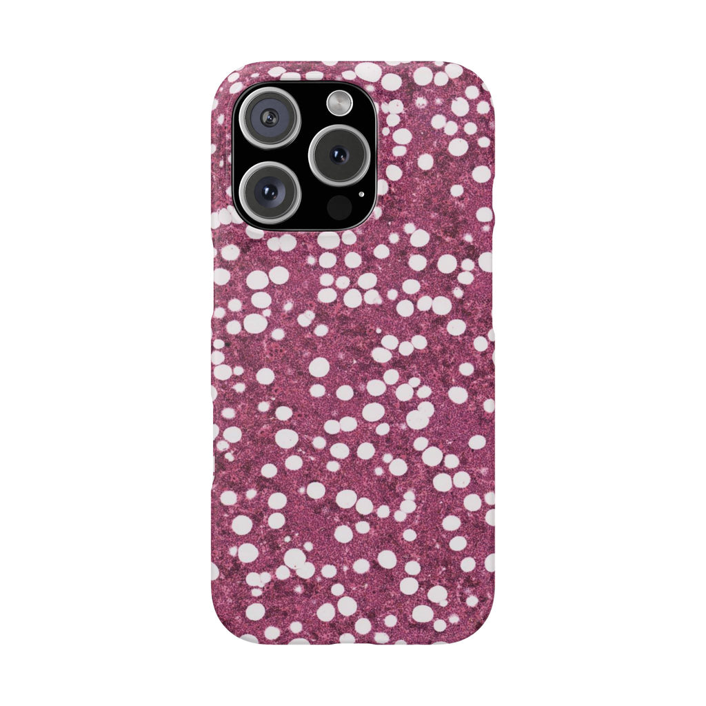 Slim Case Myelolipom