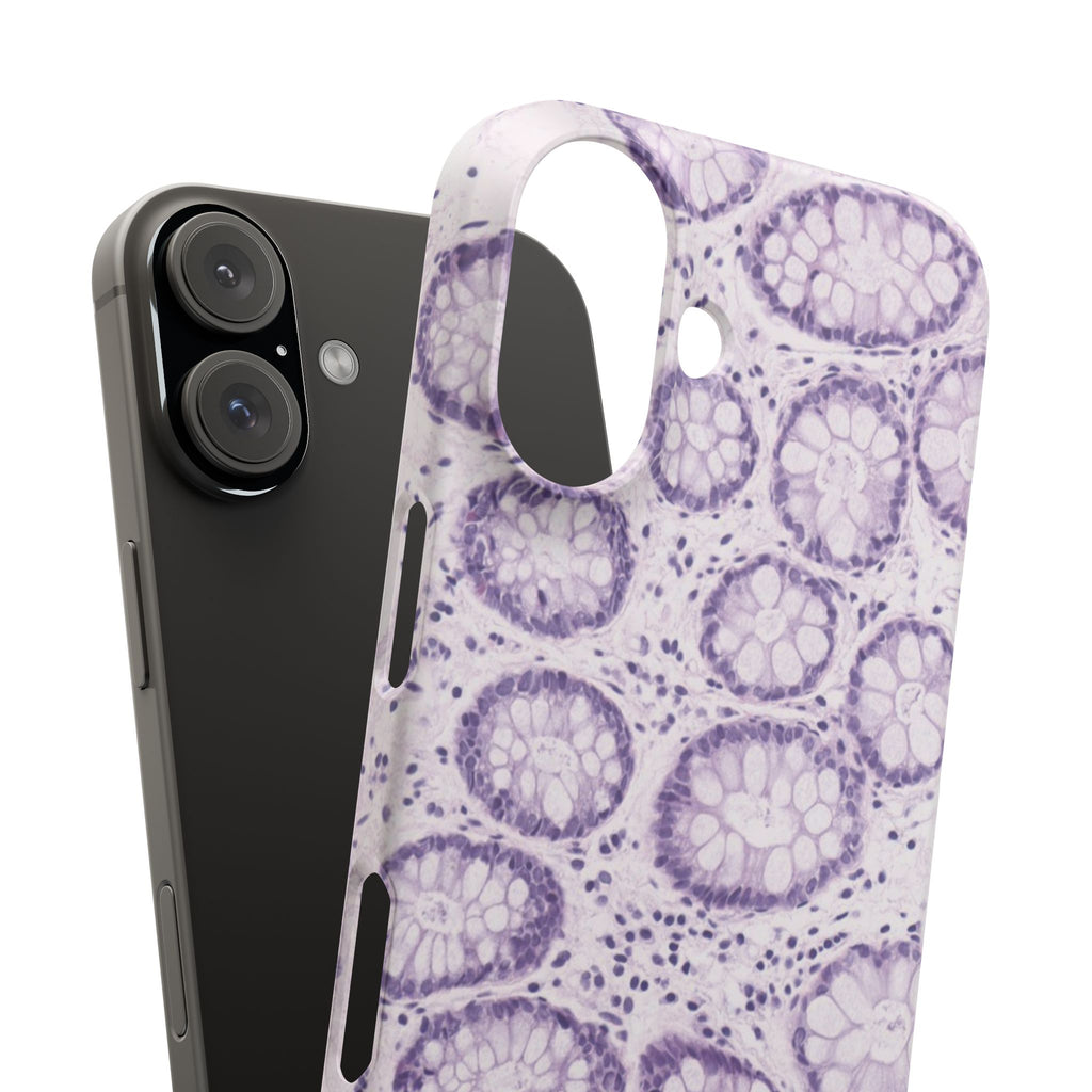 Slim Case Kolon