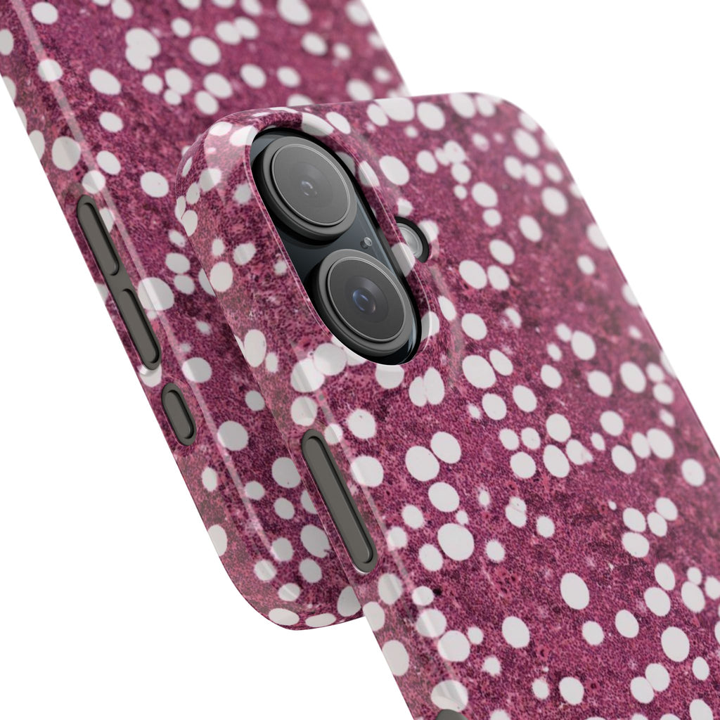 Slim Case Myelolipom