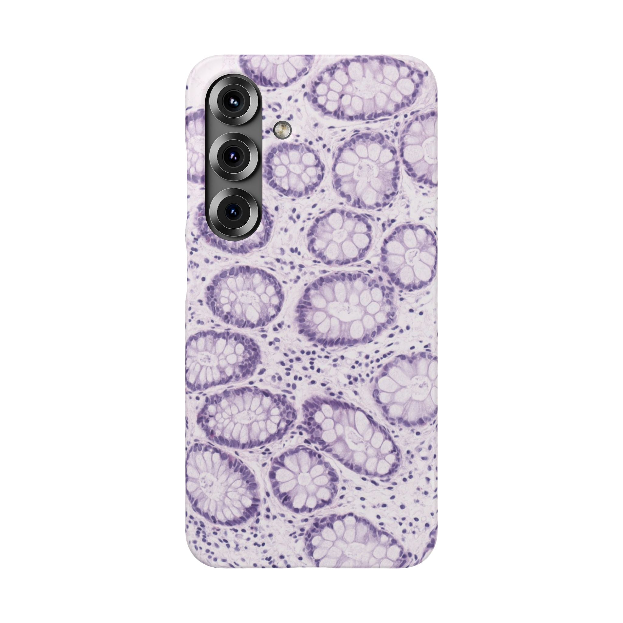 Slim Case Kolon
