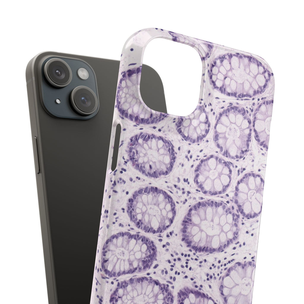 Slim Case Kolon