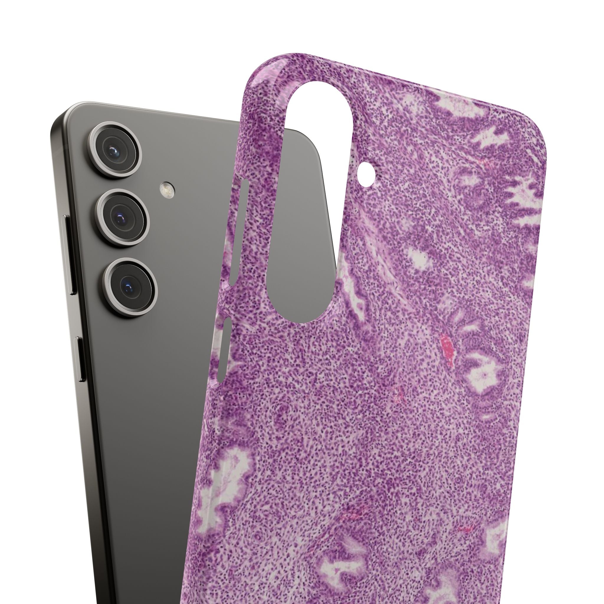 Slim Case Endometrium