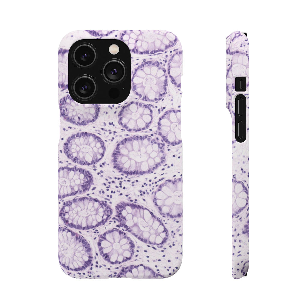 Slim Case Kolon