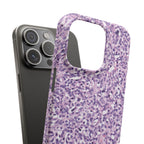 Slim Case Paraganglion