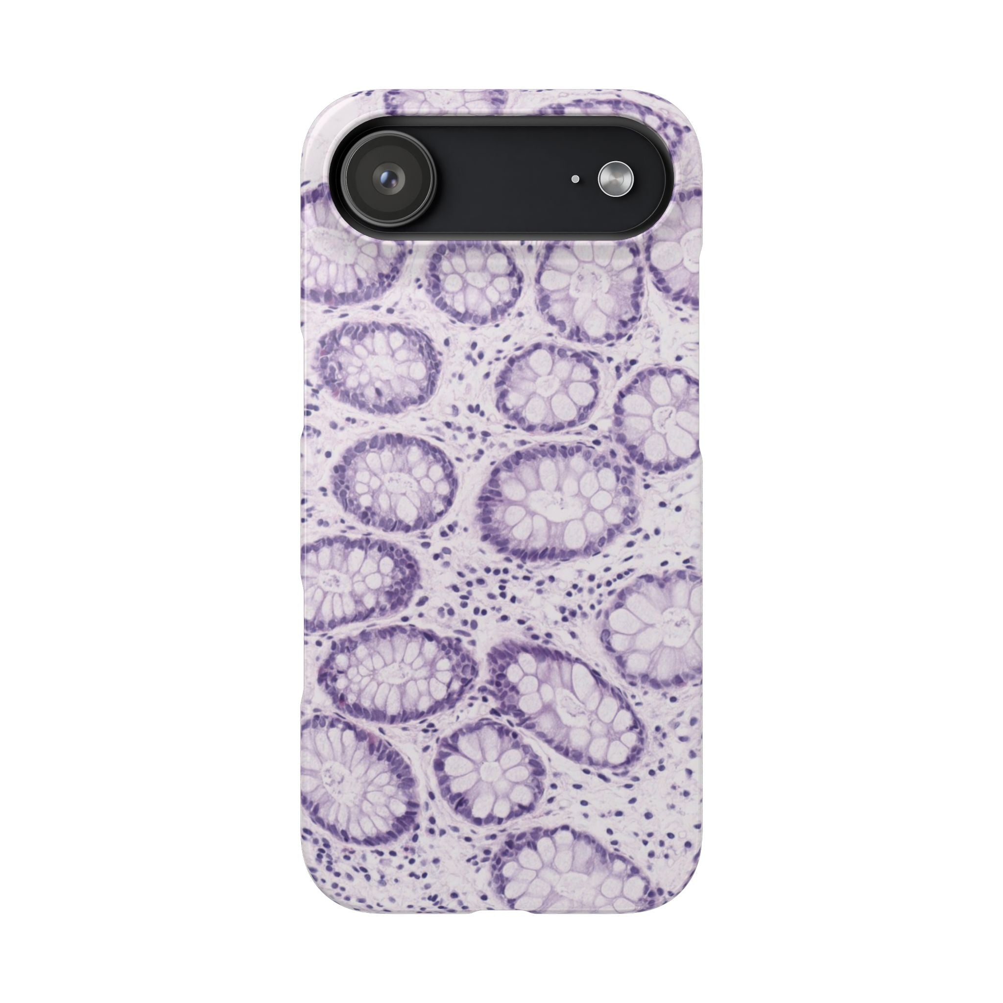Slim Case Kolon