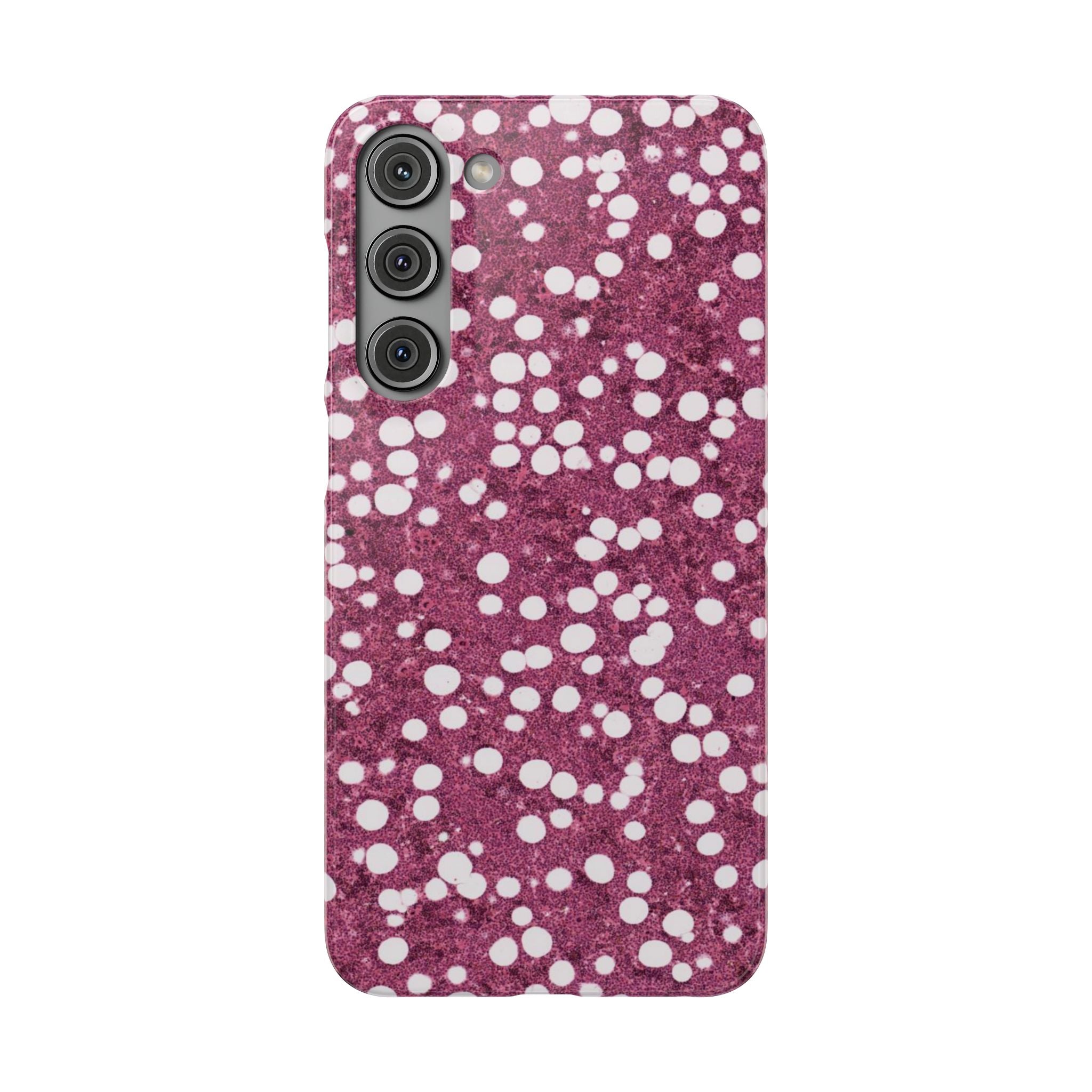 Slim Case Myelolipom