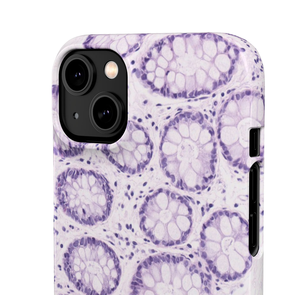 Slim Case Kolon