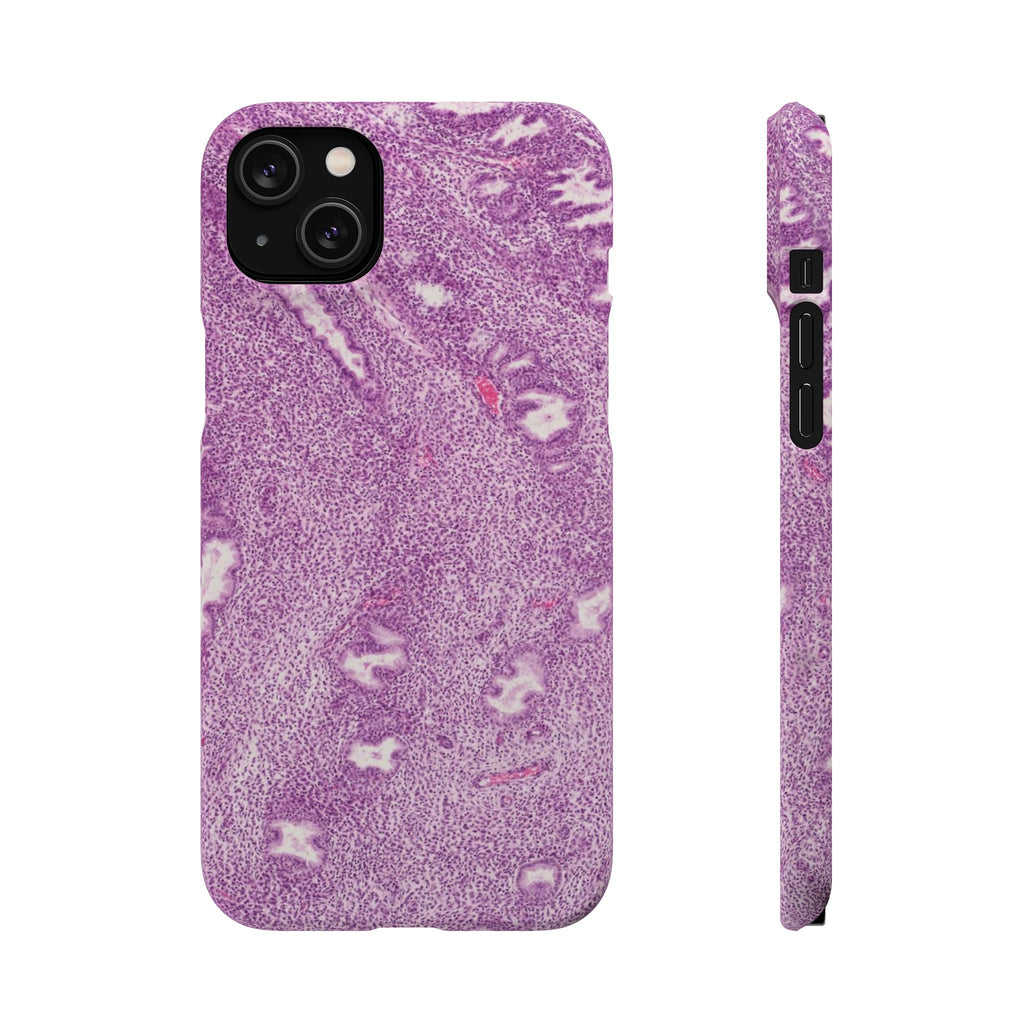 Slim Case Endometrium