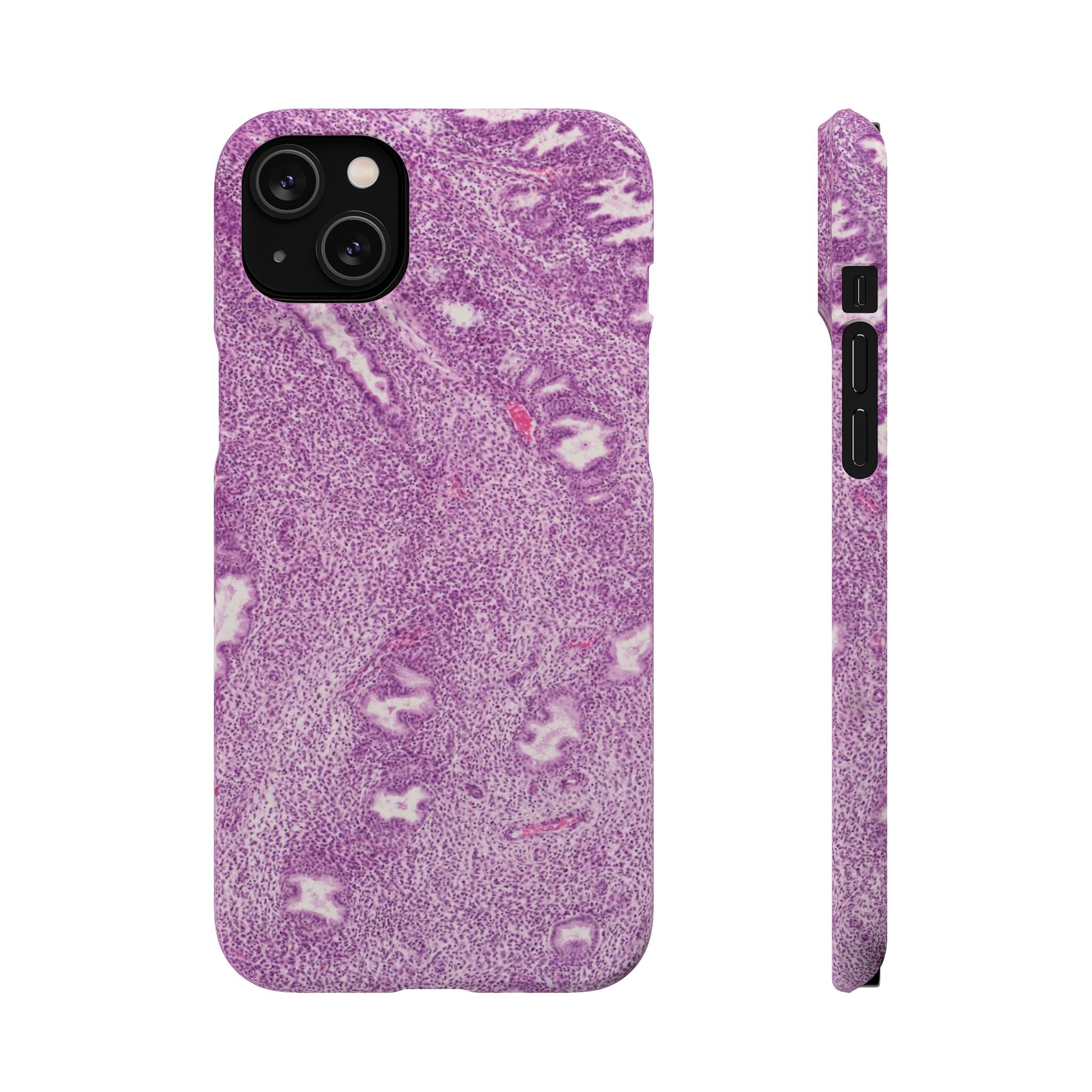 Slim Case Endometrium