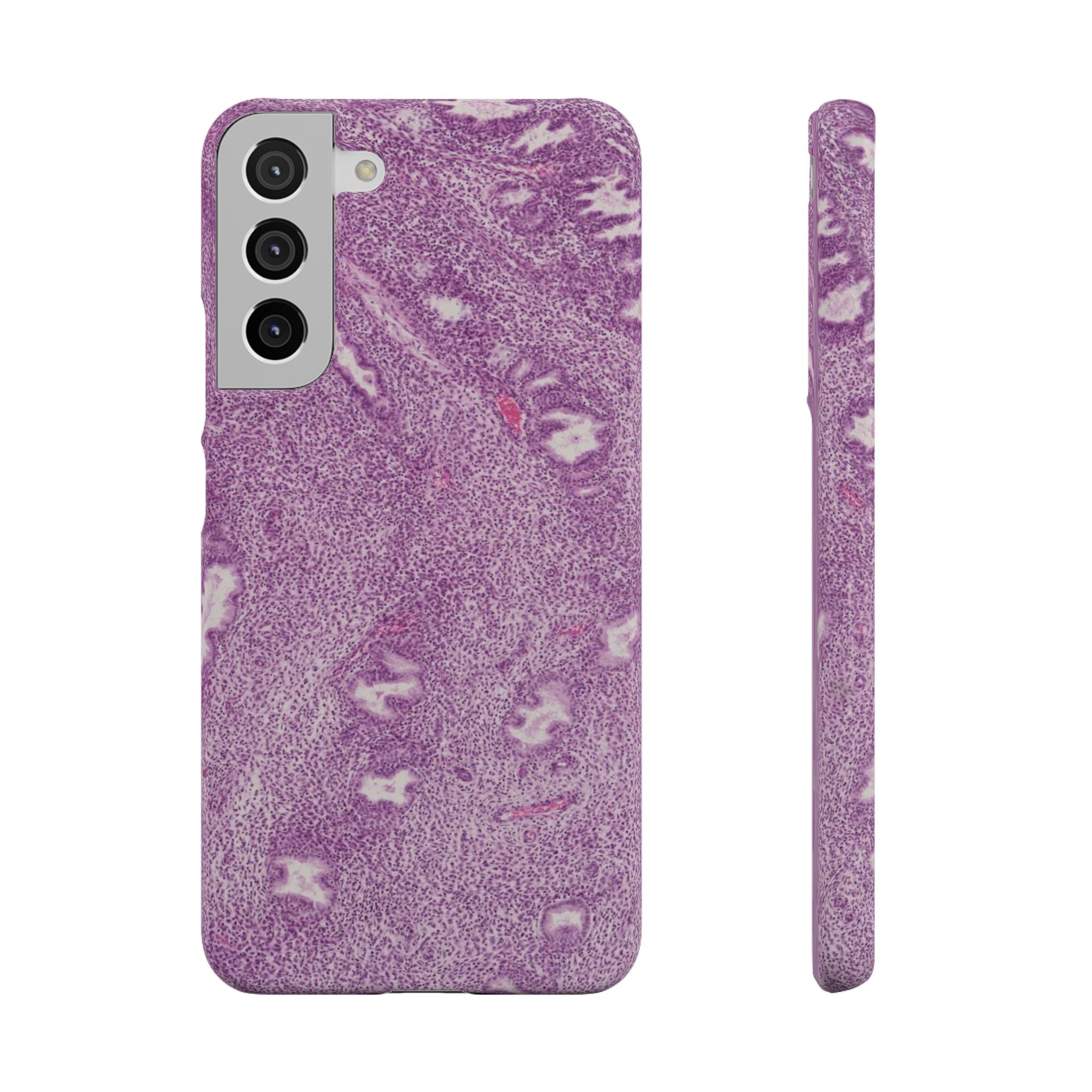Slim Case Endometrium