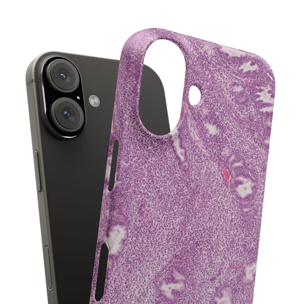 Slim Case Endometrium