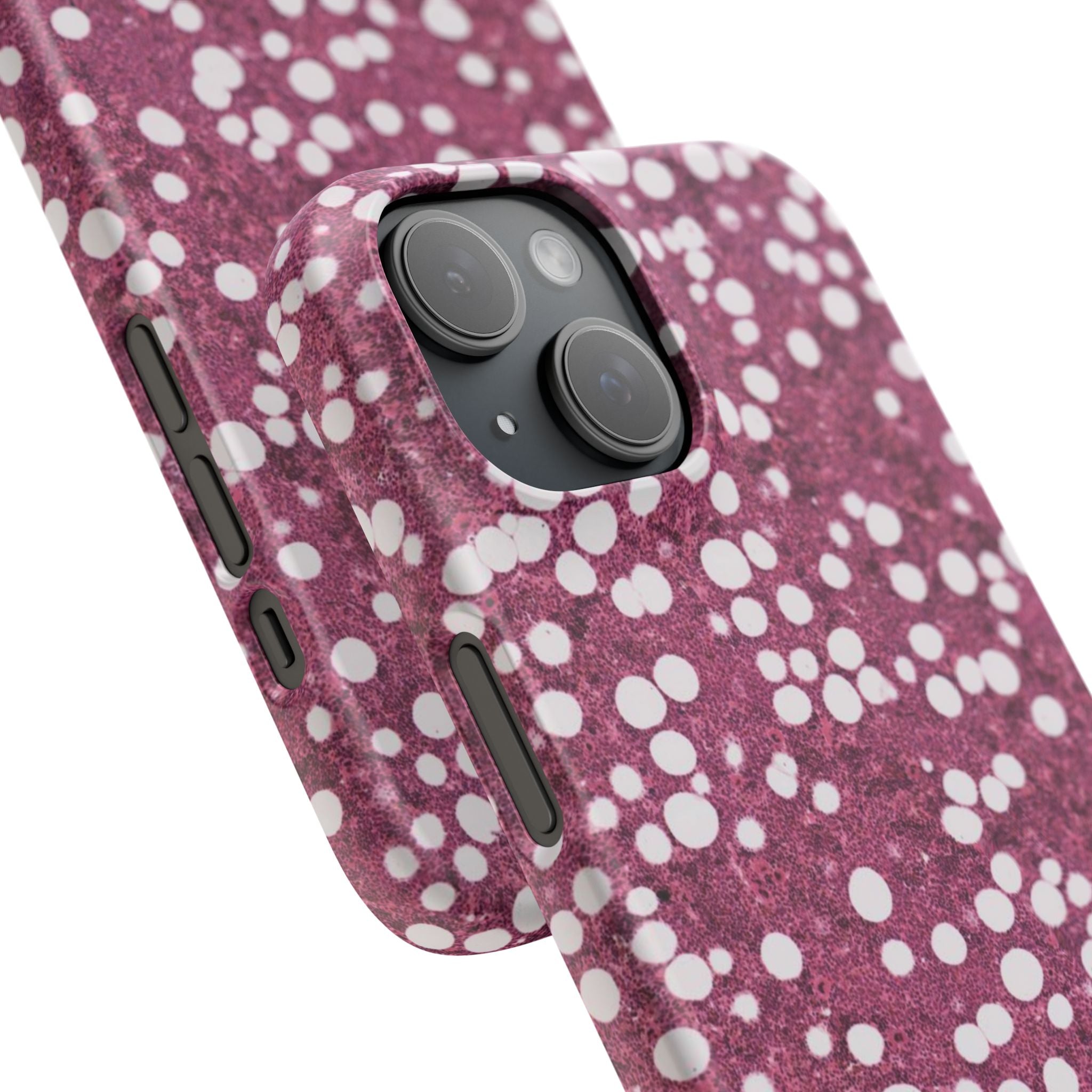 Slim Case Myelolipom
