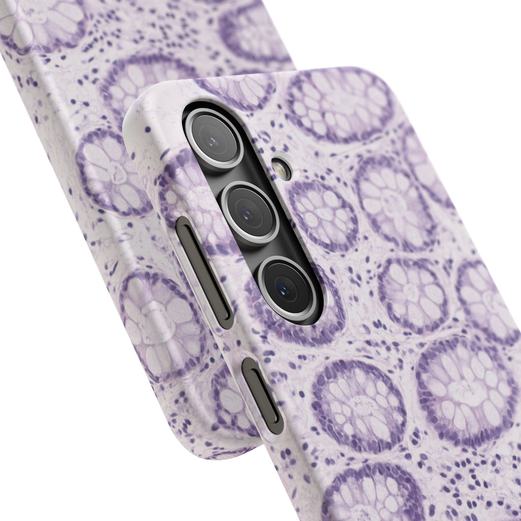 Slim Case Kolon