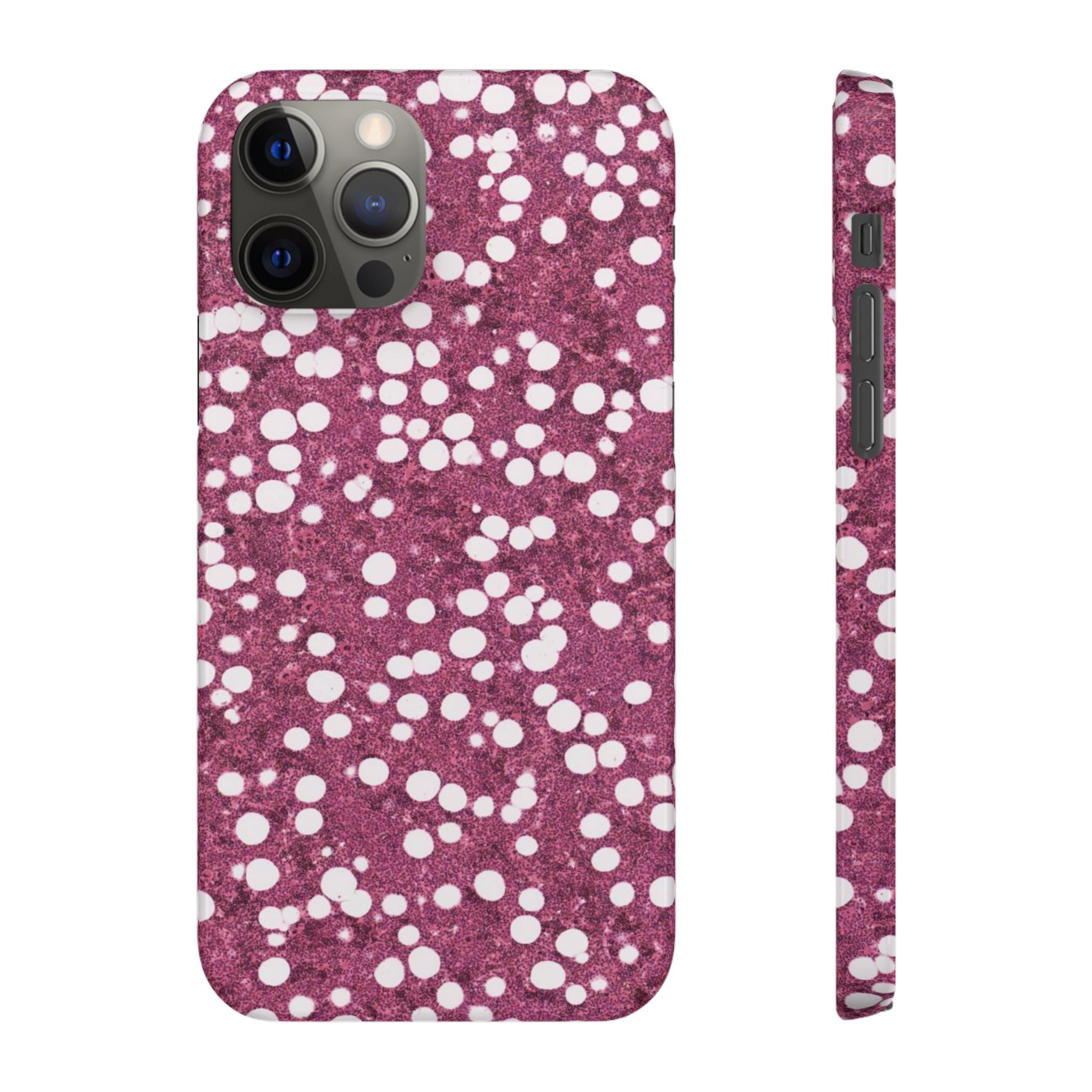 Slim Case Myelolipom