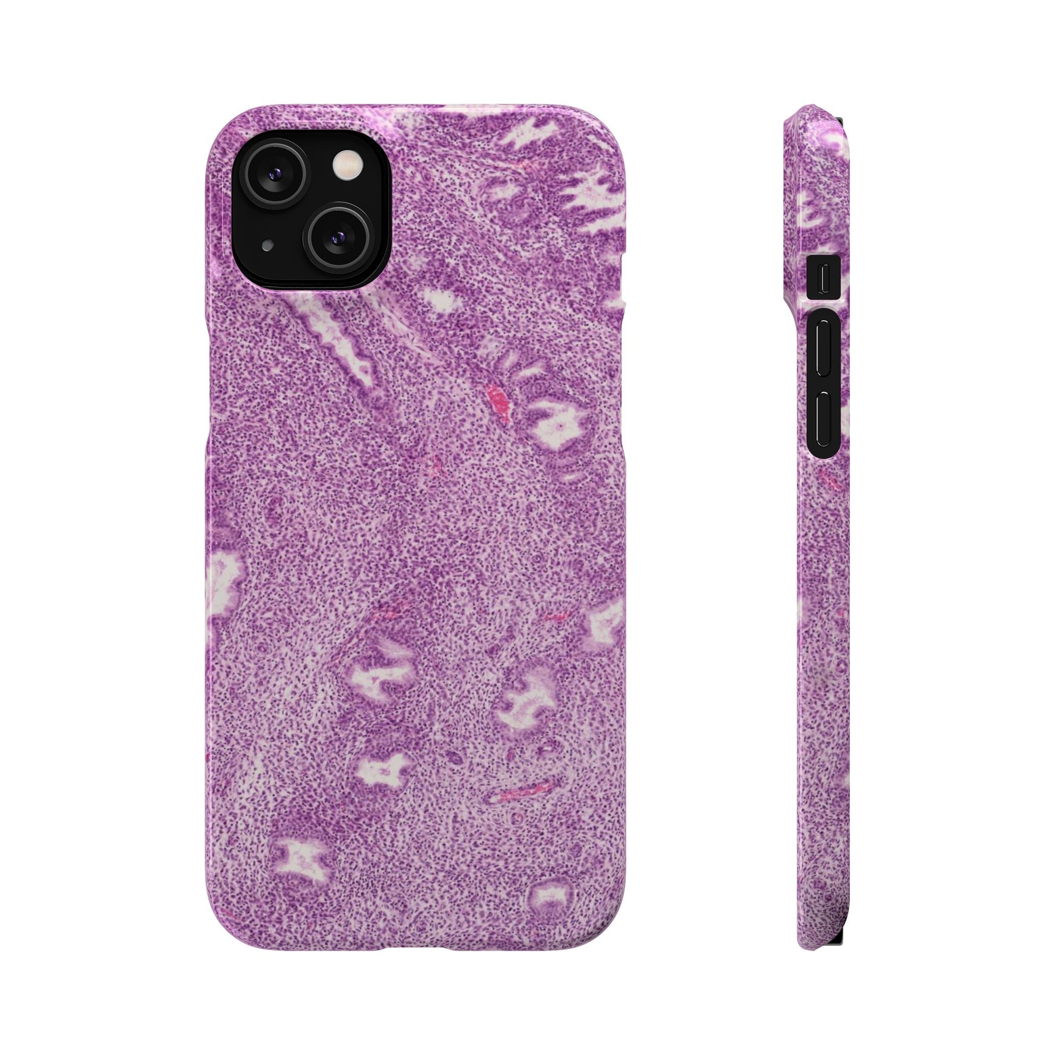 Slim Case Endometrium