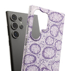 Slim Case Kolon