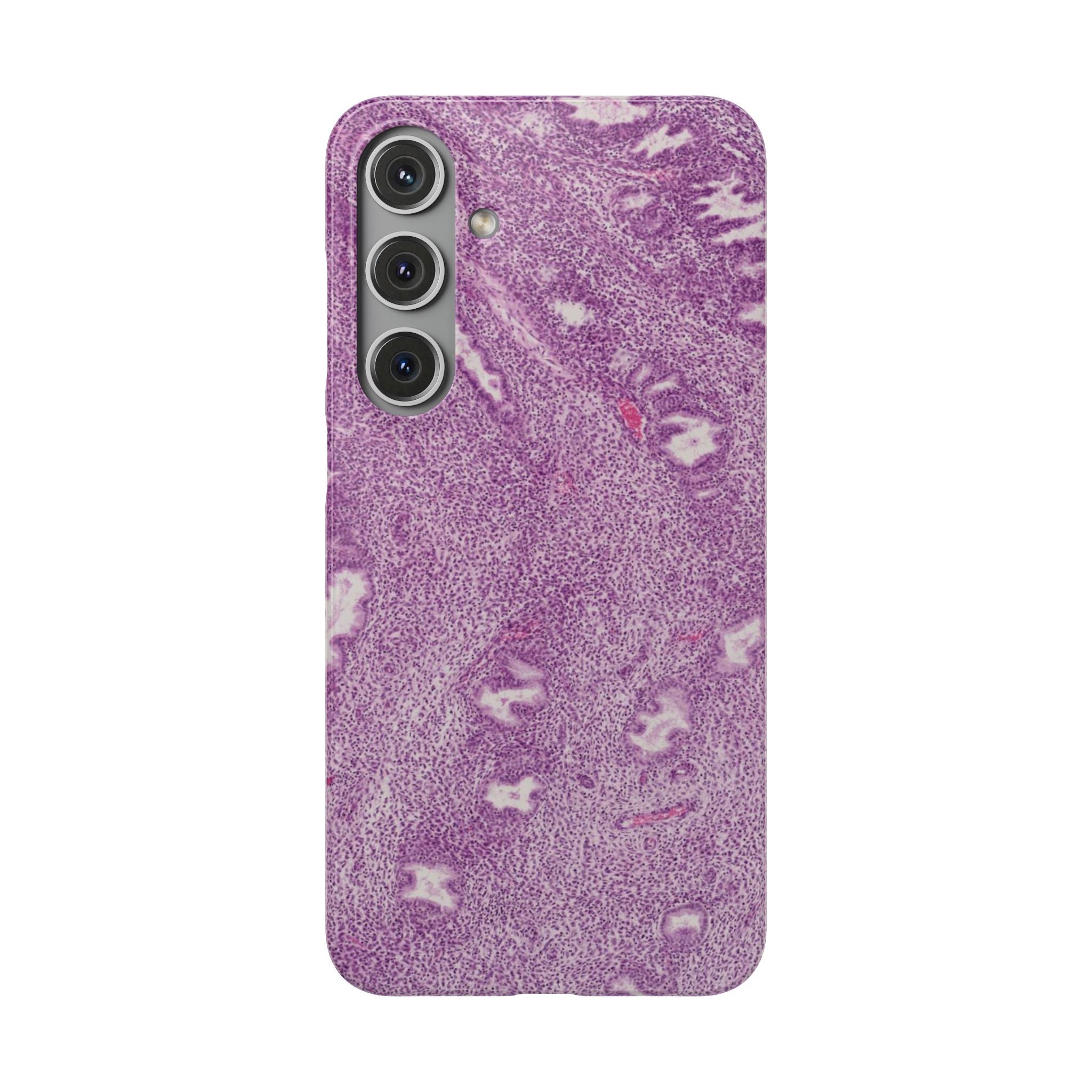 Slim Case Endometrium