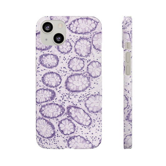 Slim Case Kolon