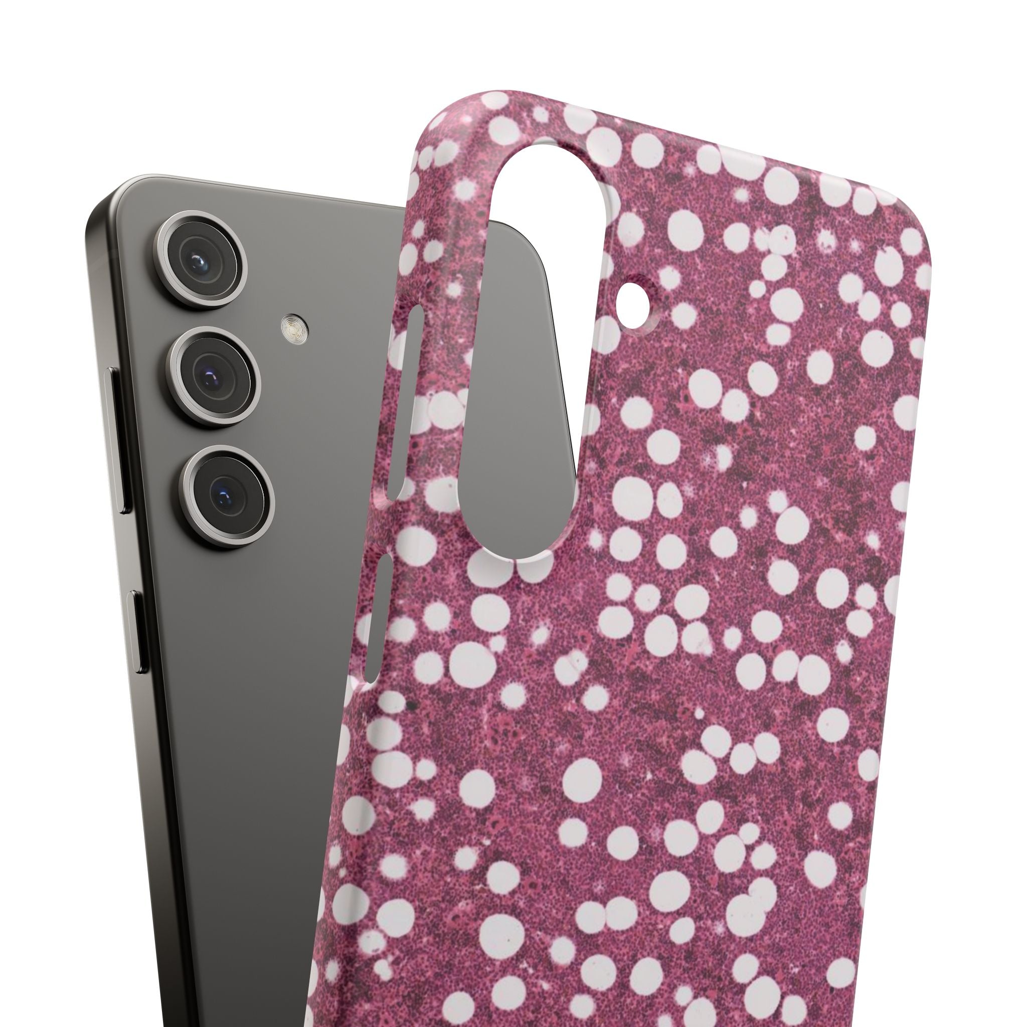 Slim Case Myelolipom