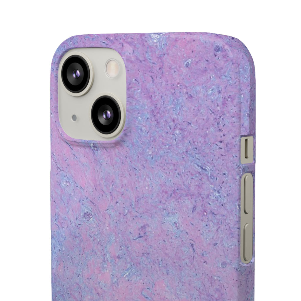 Slim Case Arterielles Myxom