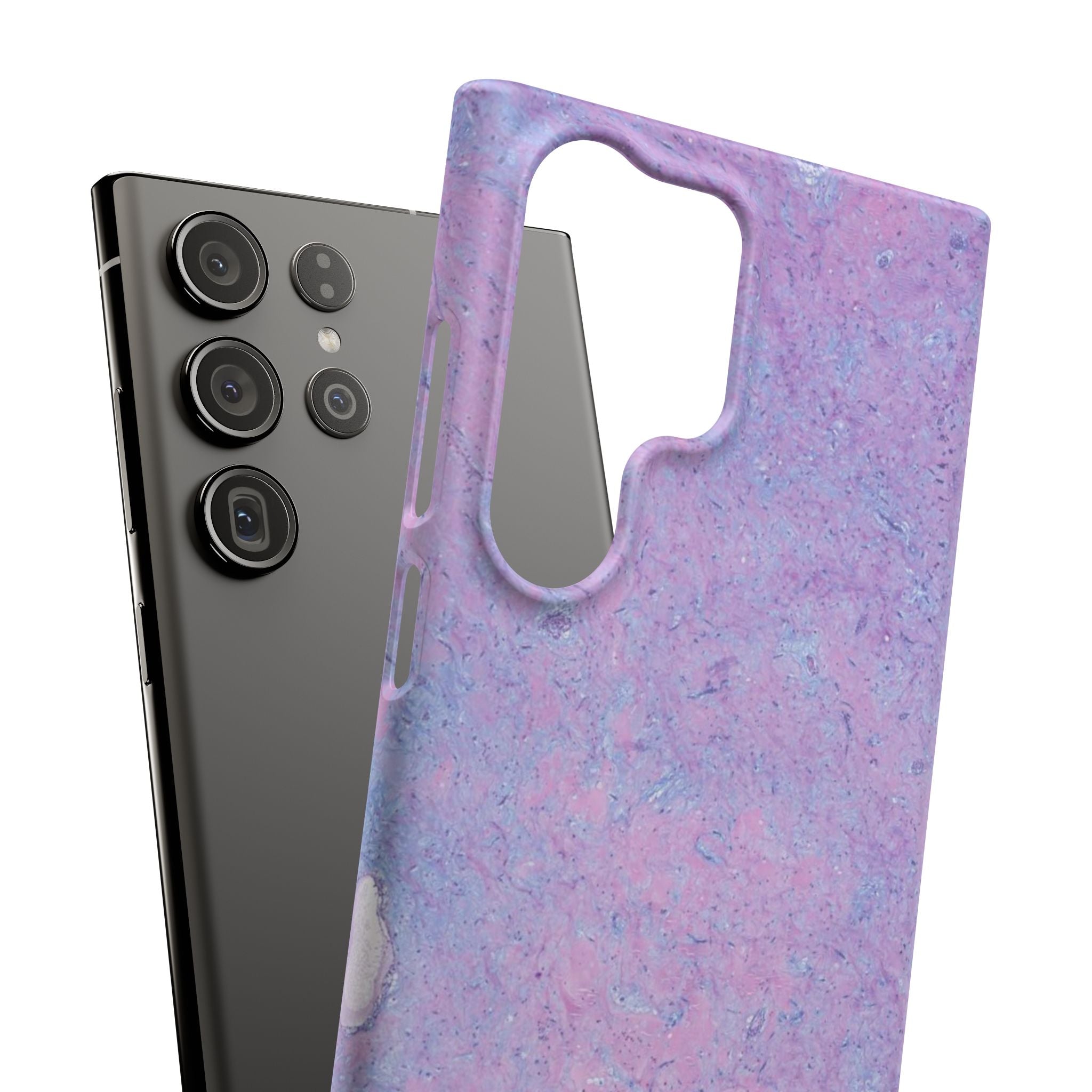 Slim Case Arterielles Myxom