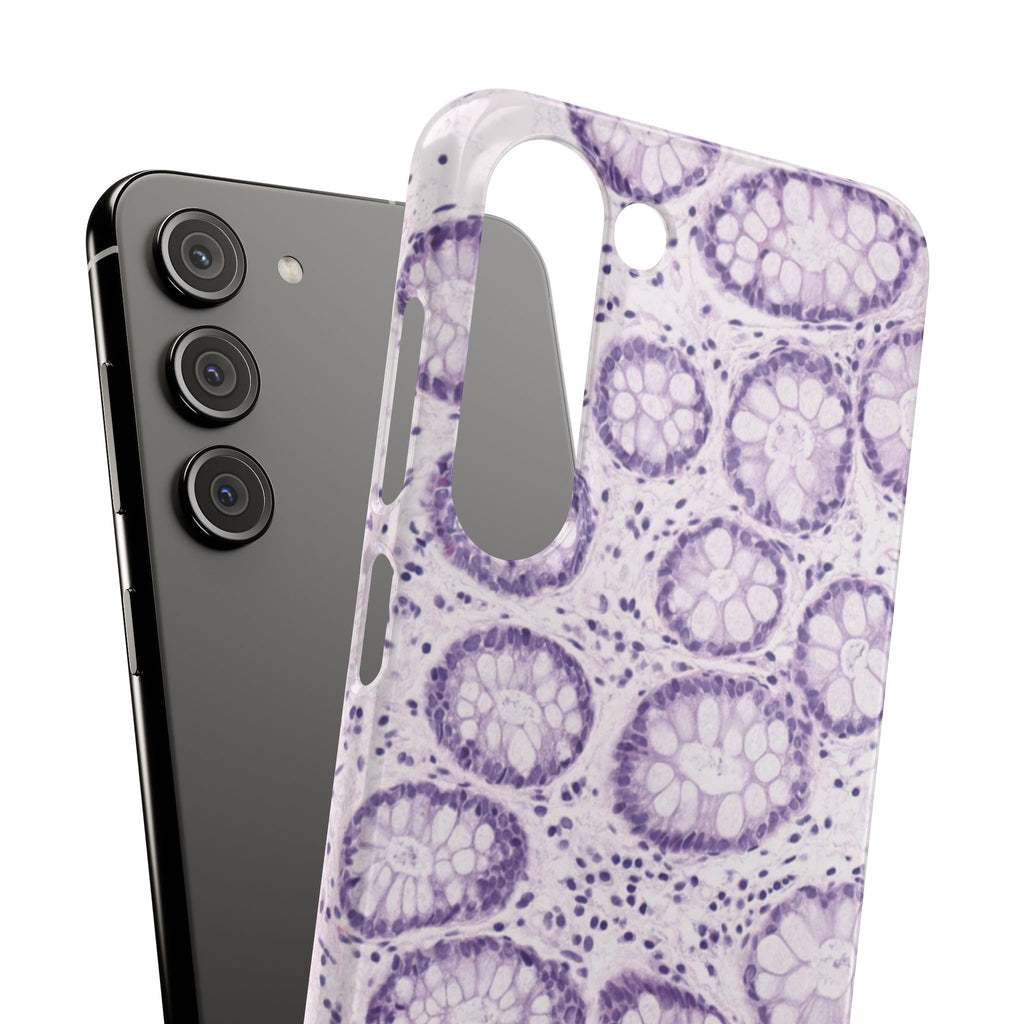 Slim Case Kolon