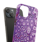 Slim Case Peutz-Jeghers Polyp