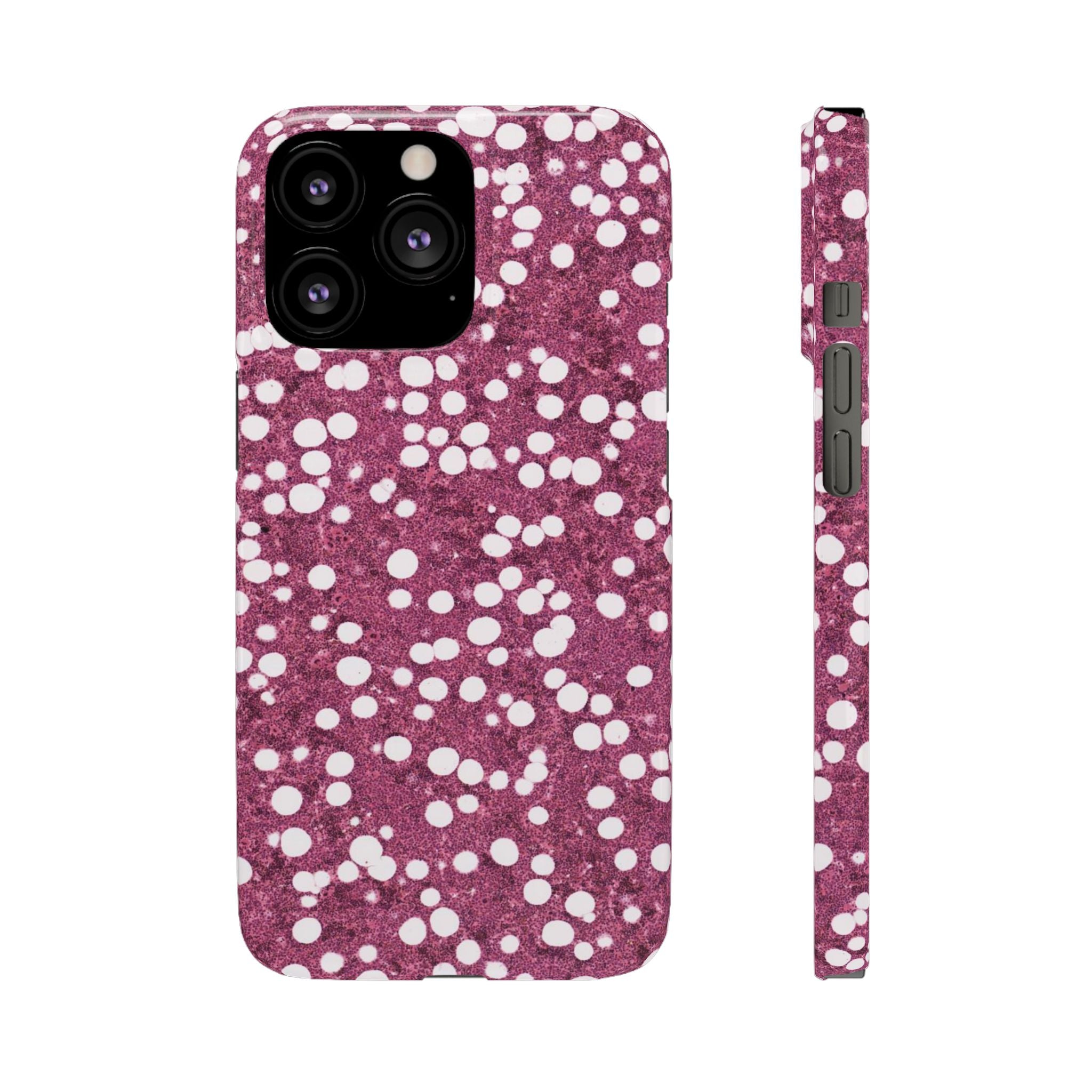 Slim Case Myelolipom