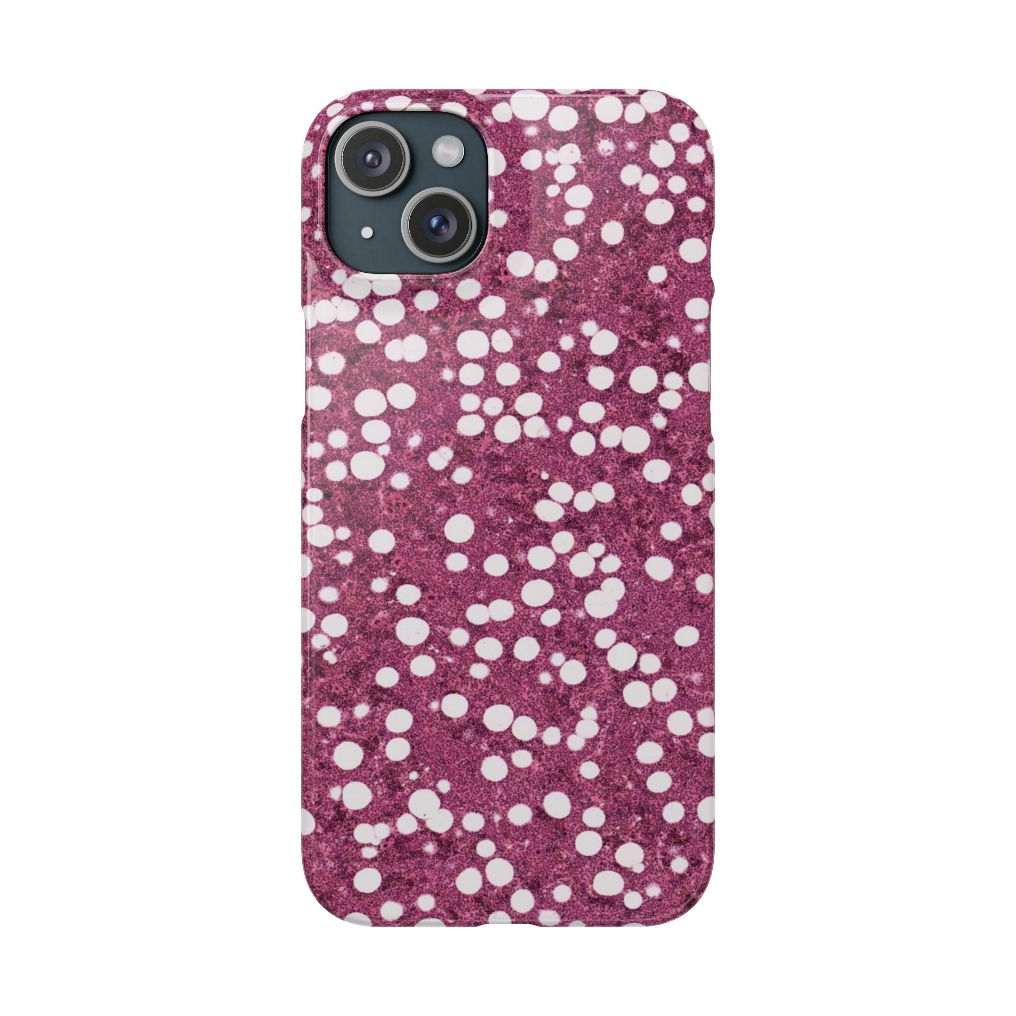 Slim Case Myelolipom