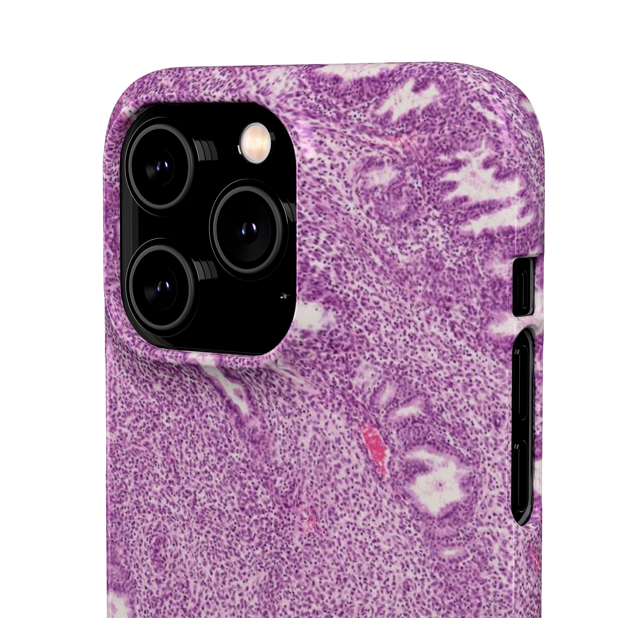 Slim Case Endometrium