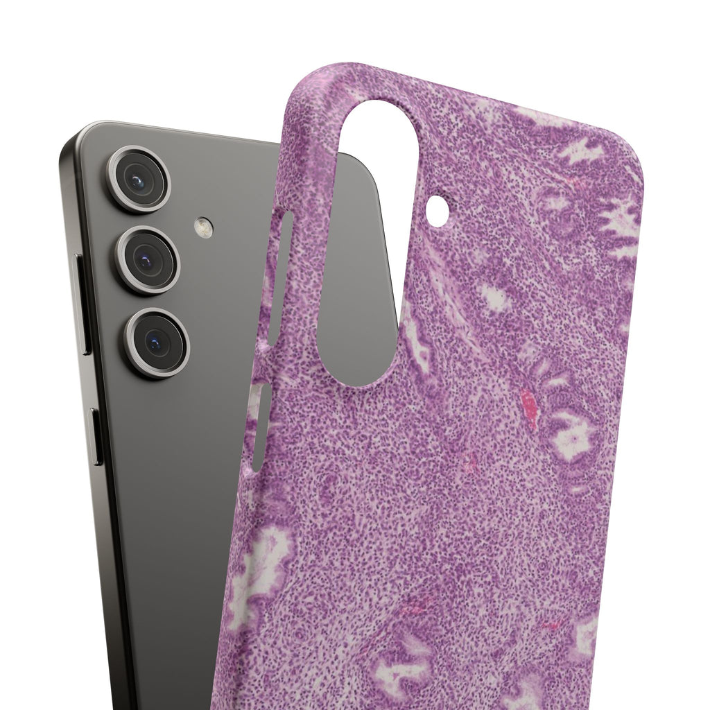 Slim Case Endometrium