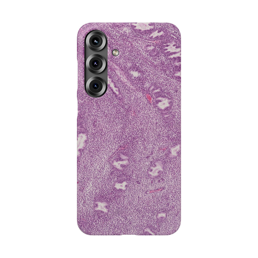 Slim Case Endometrium