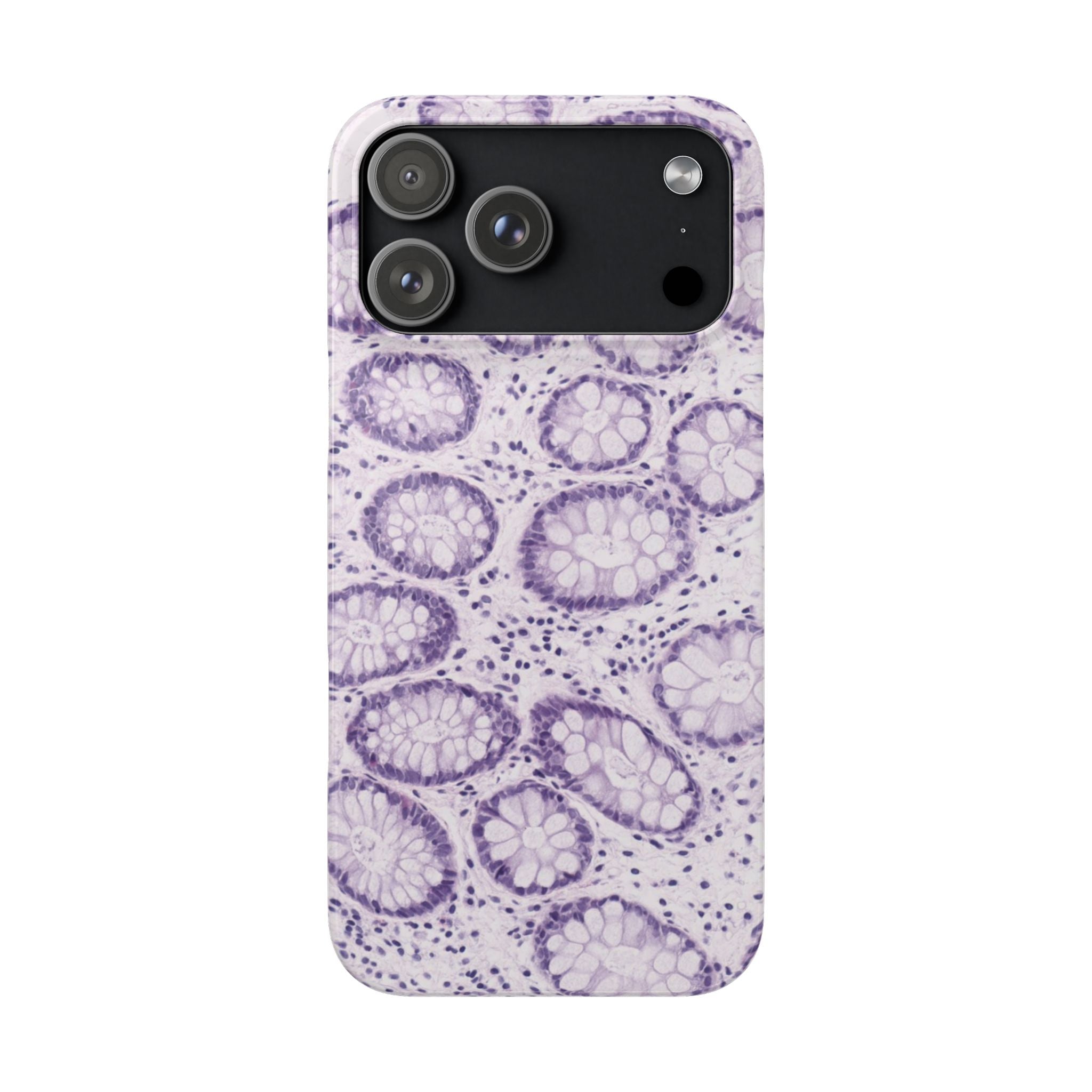 Slim Case Kolon