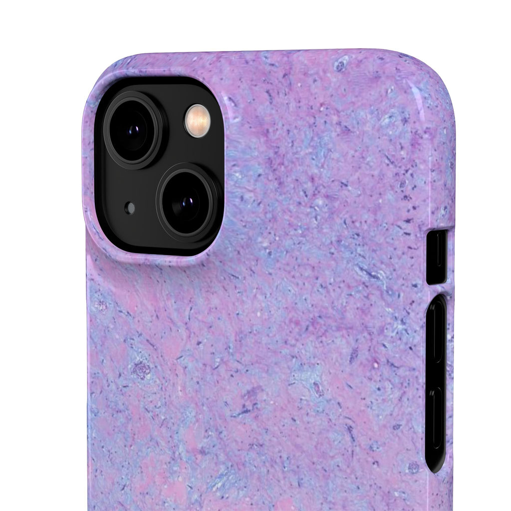 Slim Case Arterielles Myxom