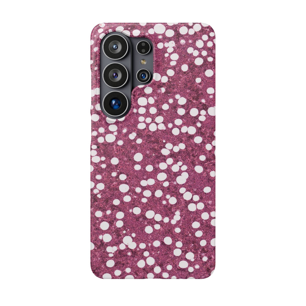 Slim Case Myelolipom