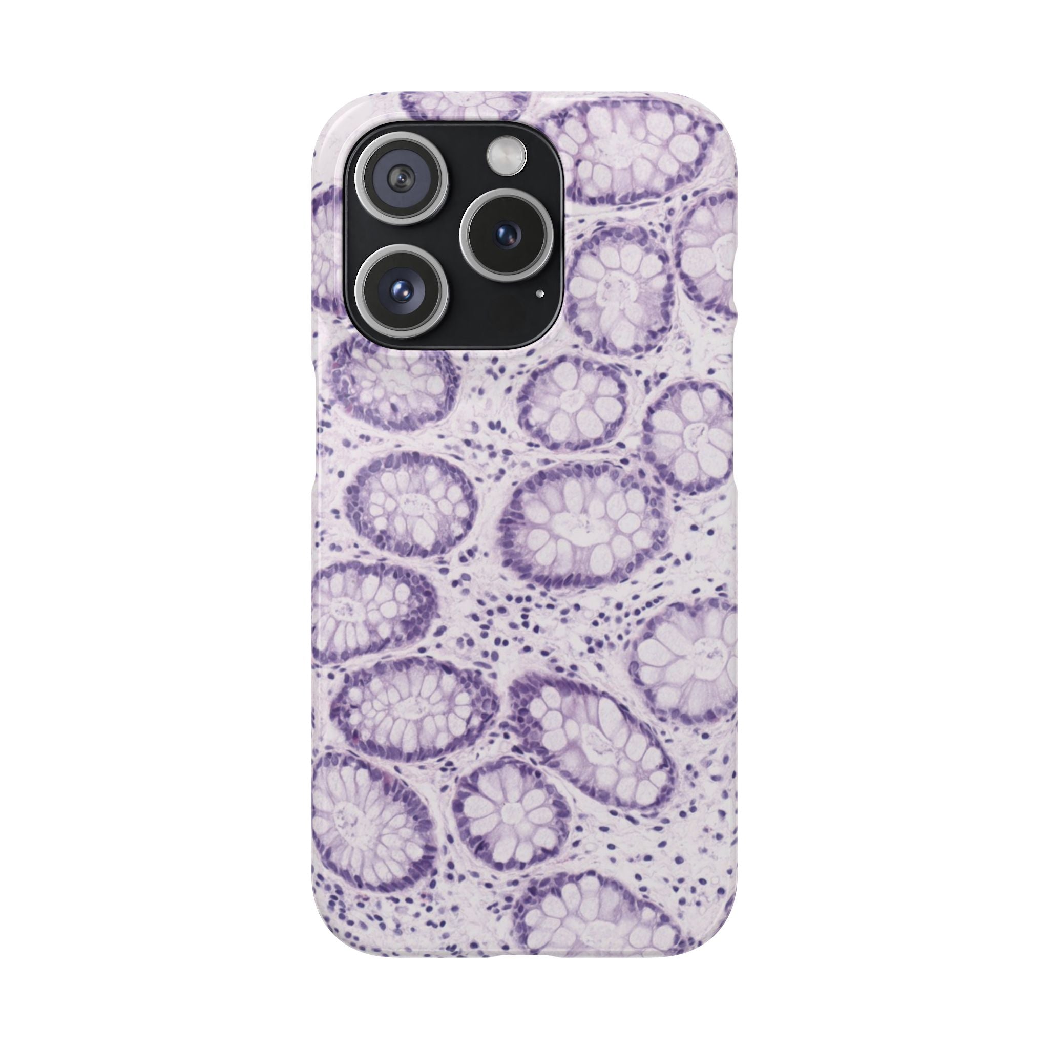 Slim Case Kolon