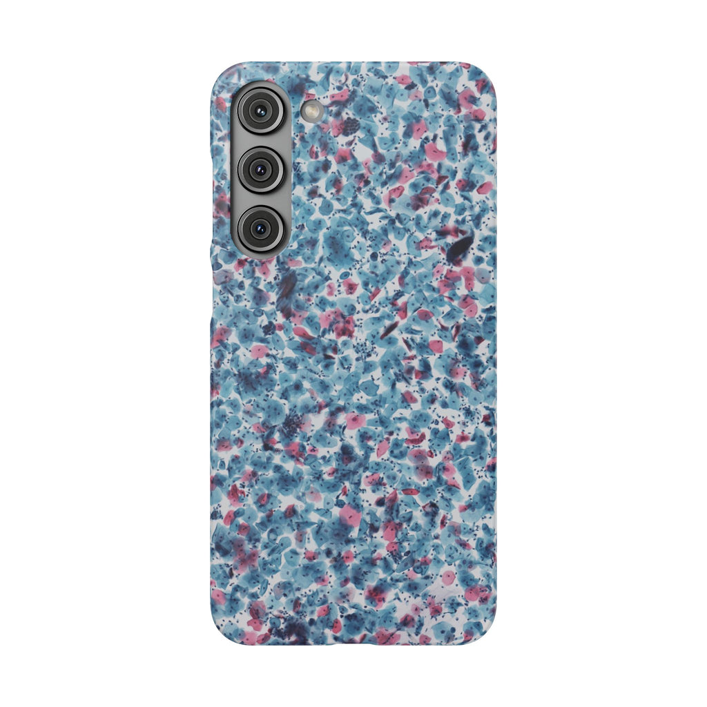 Slim Case PAP
