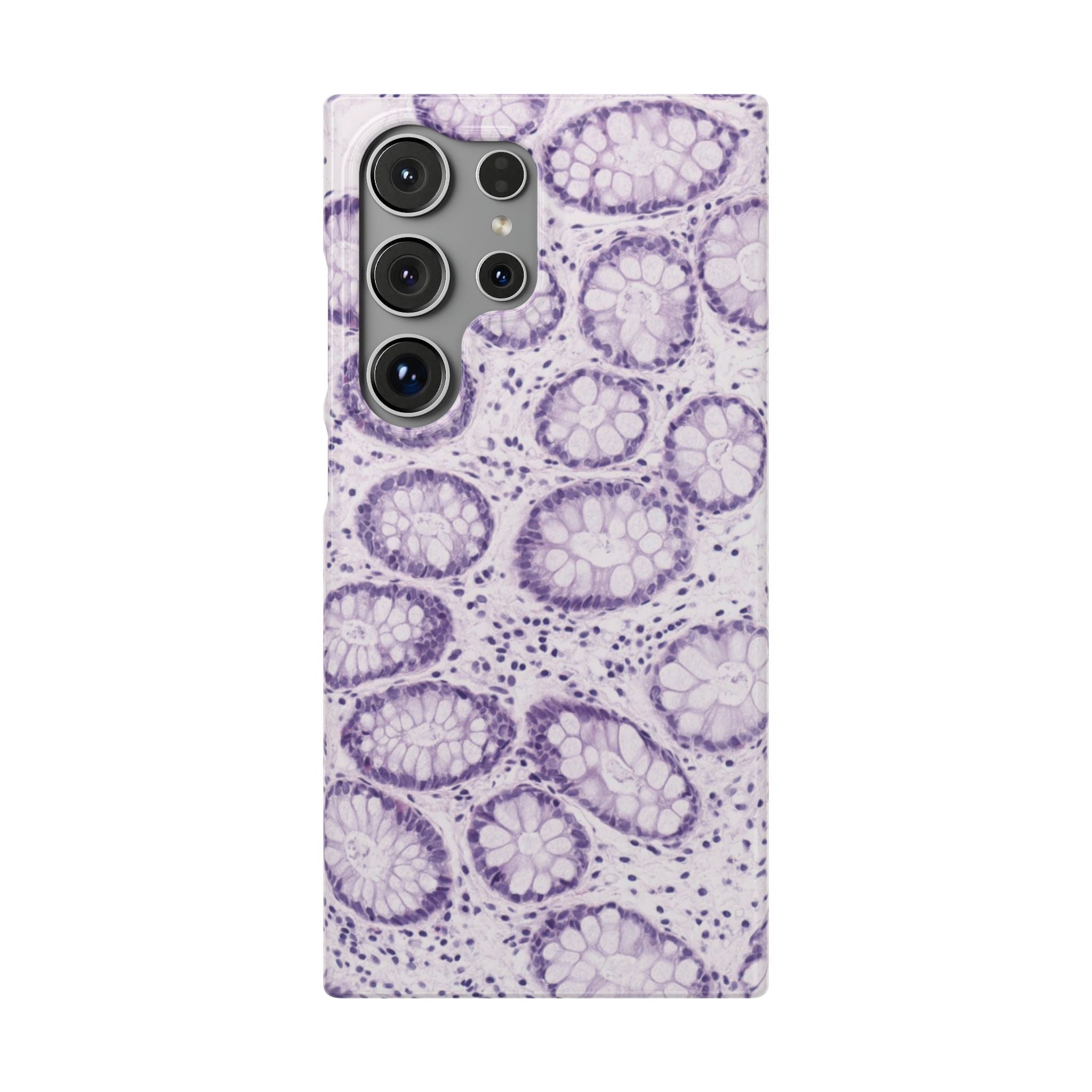 Slim Case Kolon