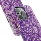 Slim Case Peutz-Jeghers Polyp