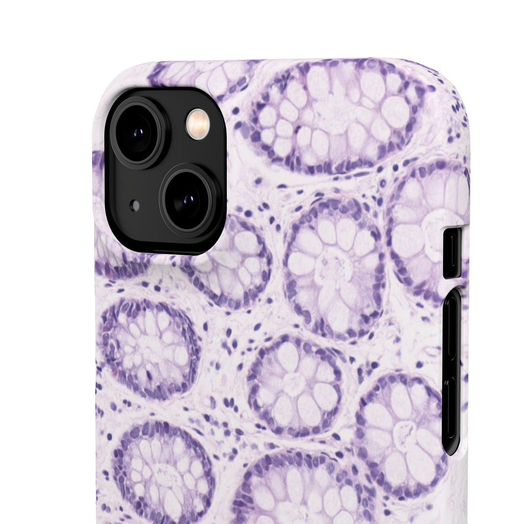 Slim Case Kolon