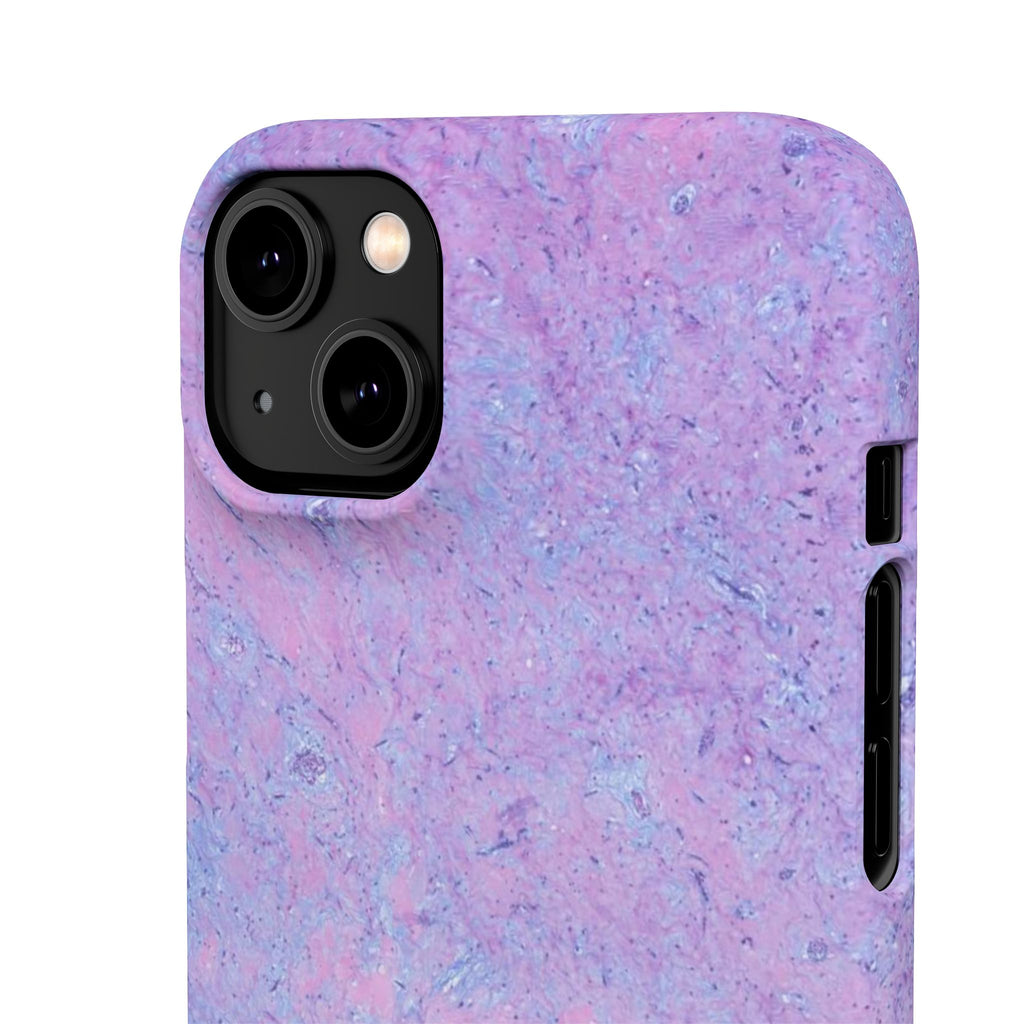 Slim Case Arterielles Myxom